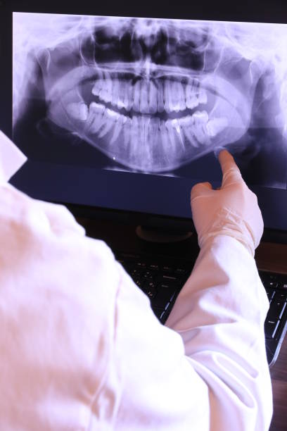 Best Emergency Dental Extractions in Tazewell, VA
