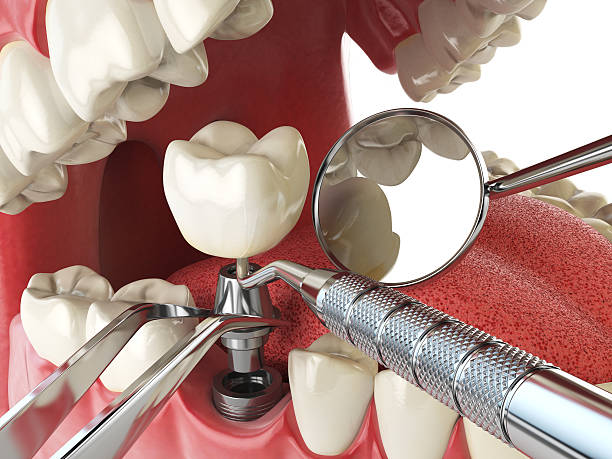 Best Holiday Emergency Dentist in Tazewell, VA